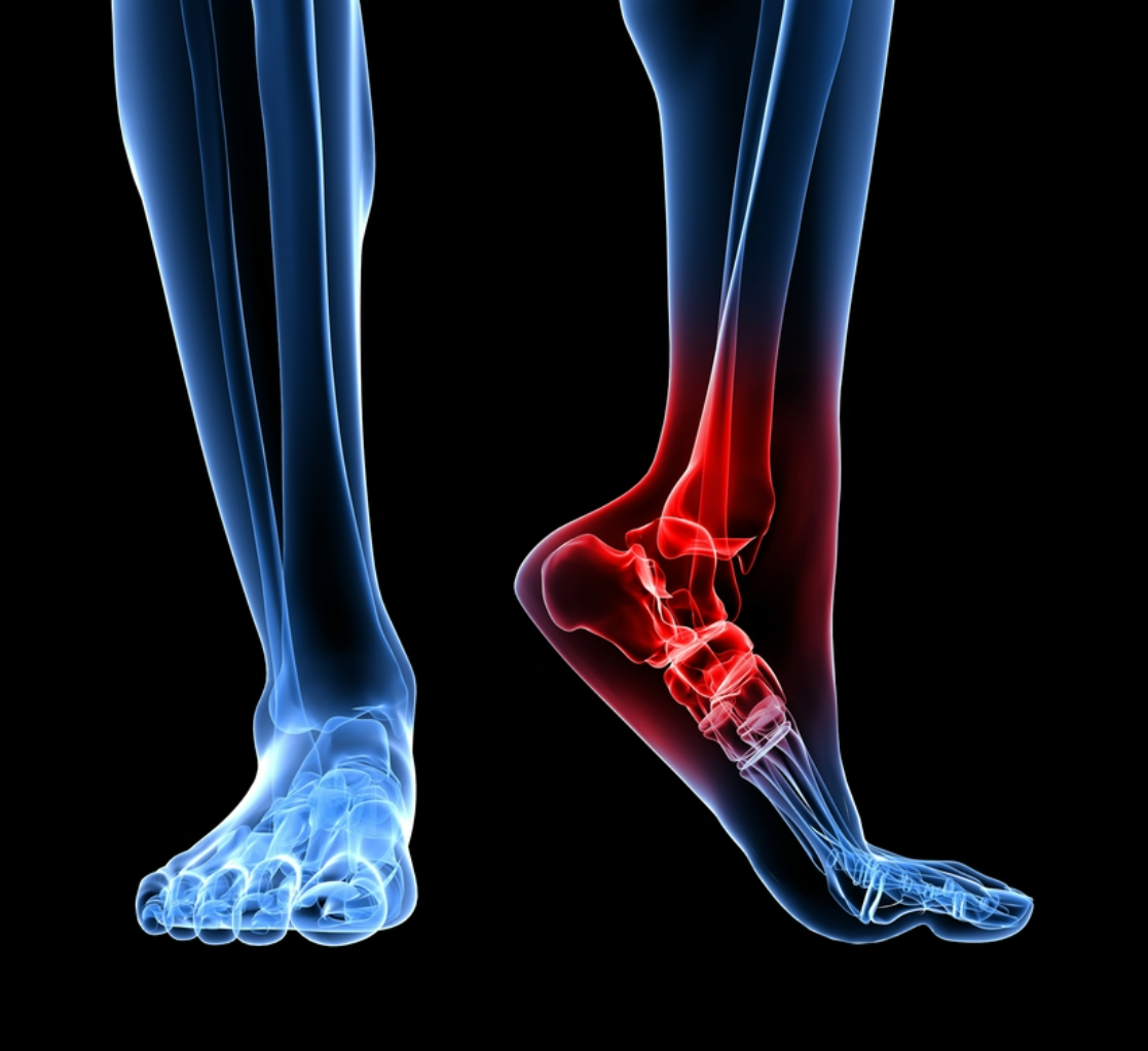 Sandales orthopédiques pour femmes | Confort-CHAUSSURES ORTHOPÉDIQUES-PARIS FEMME