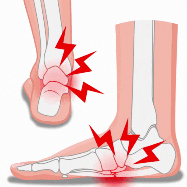 Semelles pour la Fasciite Plantaire-CHAUSSURES ORTHOPÉDIQUES-PARIS FEMME