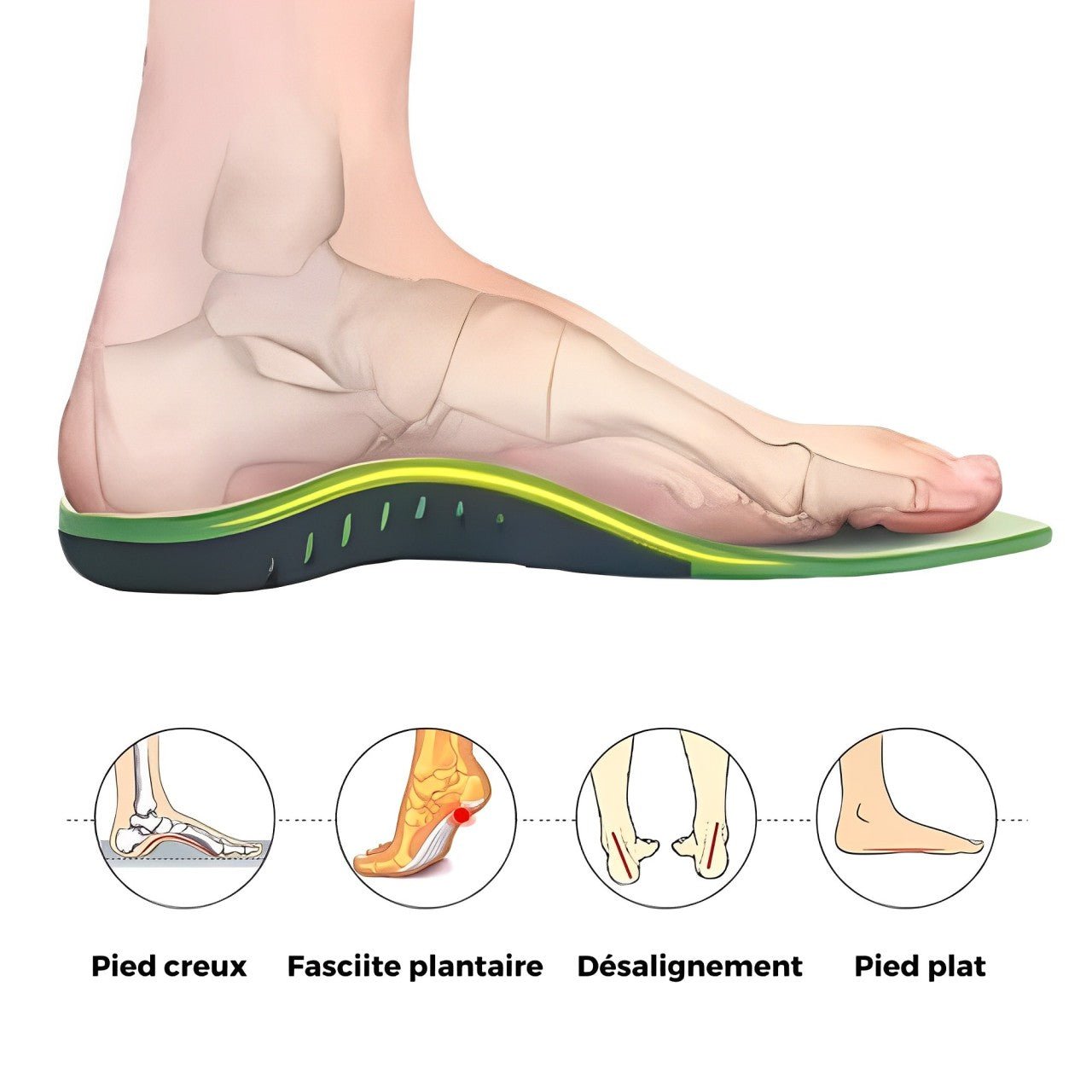Semelles pour la Fasciite Plantaire-CHAUSSURES ORTHOPÉDIQUES-PARIS FEMME