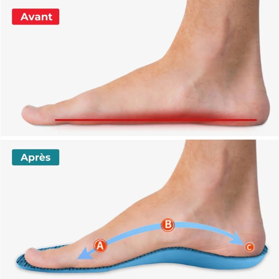 Semelles orthopédiques hallux valgus-CHAUSSURES ORTHOPÉDIQUES-PARIS FEMME