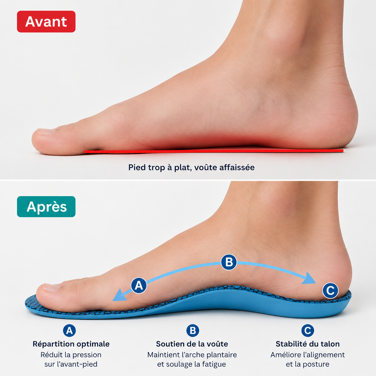 Semelles Orthopédiques Hallux Valgus Confort Correctif